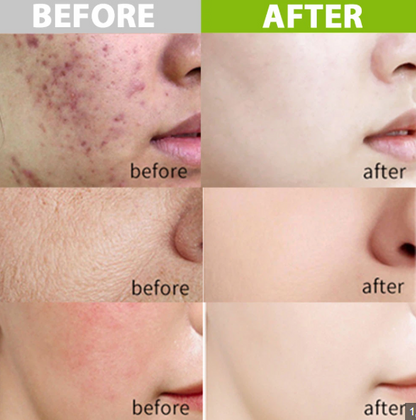 Complex Acid Avocado Cleansing Facial Bubble Mask